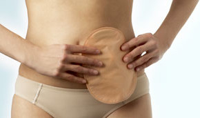 Stomazorg